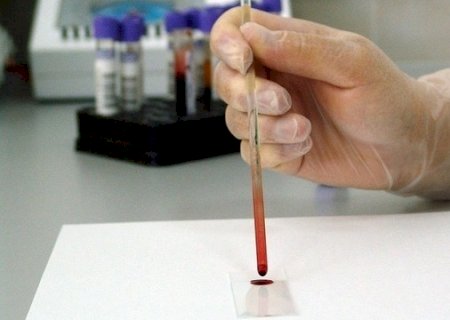 Doença misteriosa em MG pode ser envenenamento por metal pesado