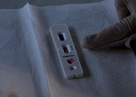 Testes particulares de Covid-19 custam de R$ 139 a R$ 400