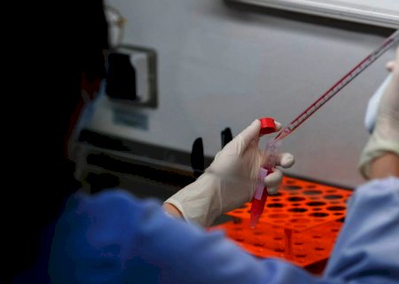 Aumento no número de casos coloca 31 municípios em grau de risco da covid-19