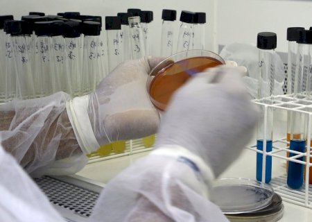 Valores cobrados por exames laboratoriais apresentam variação de mais de 1.500%