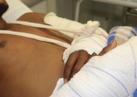 Por ano, Santa Casa atende 3 mil pacientes vitimas de acidente no trânsito